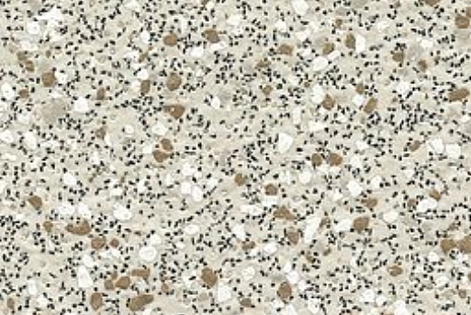 Liuni SpA Pavimenti vinilici antiscivolo POLYSAFE CORONA PUR - 3