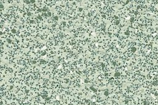 Liuni SpA Pavimenti vinilici antiscivolo POLYSAFE CORONA PUR - 4